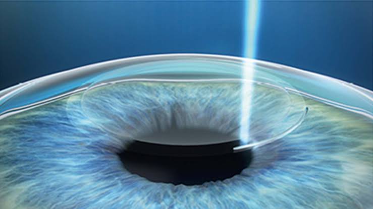 Eye care services at Anand Eye Centre Aligarh