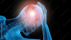 Ocular Migraine